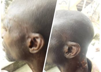 I was shot, my bike stolen by suspected armed robbers, commercial motorcycle operator cries out in Delta