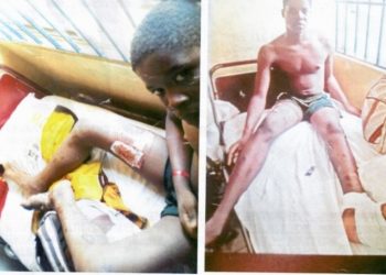 Levant allegedly abandons 18yr old staff who broke his left leg onsite in Delta