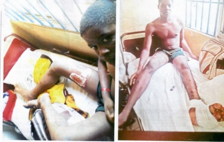 Levant allegedly abandons 18yr old staff who broke his left leg onsite in Delta