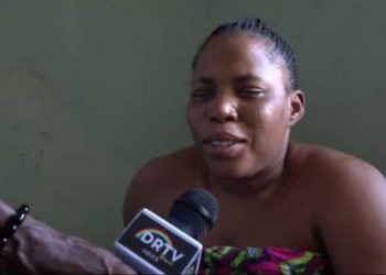 Single mother in Warri appeals for 2.5m naira for hip surgery to walk again