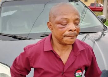 Ajaero surfaces with bruised face after alleged abduction