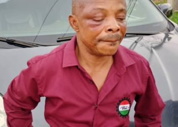 NLC President to get treatment abroad over attack in Imo